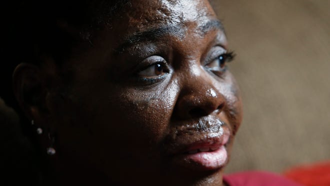 Francine Wallace is recovering from severe burns after her ex-boyfriend tried to kill her by fire in June 2014.