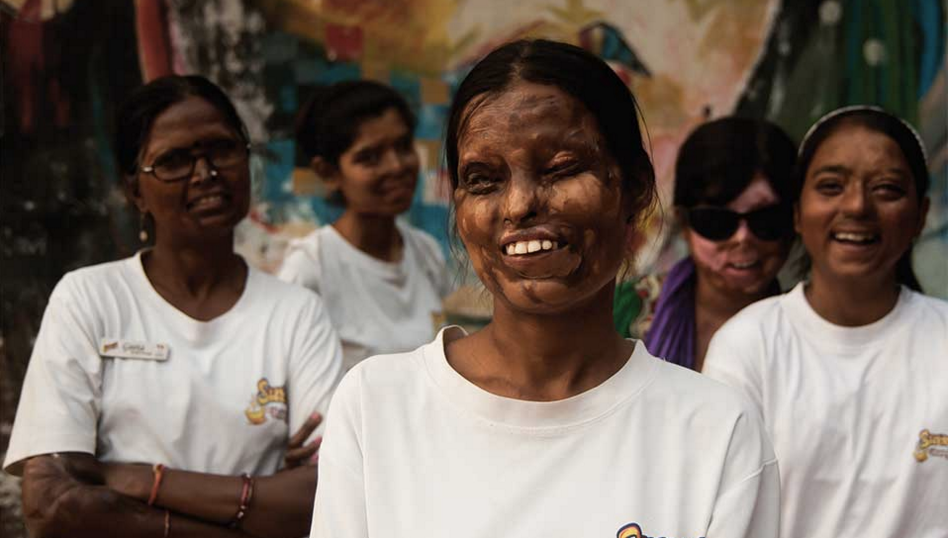 Acid attacks against women in India Incidents up; survivors fight back