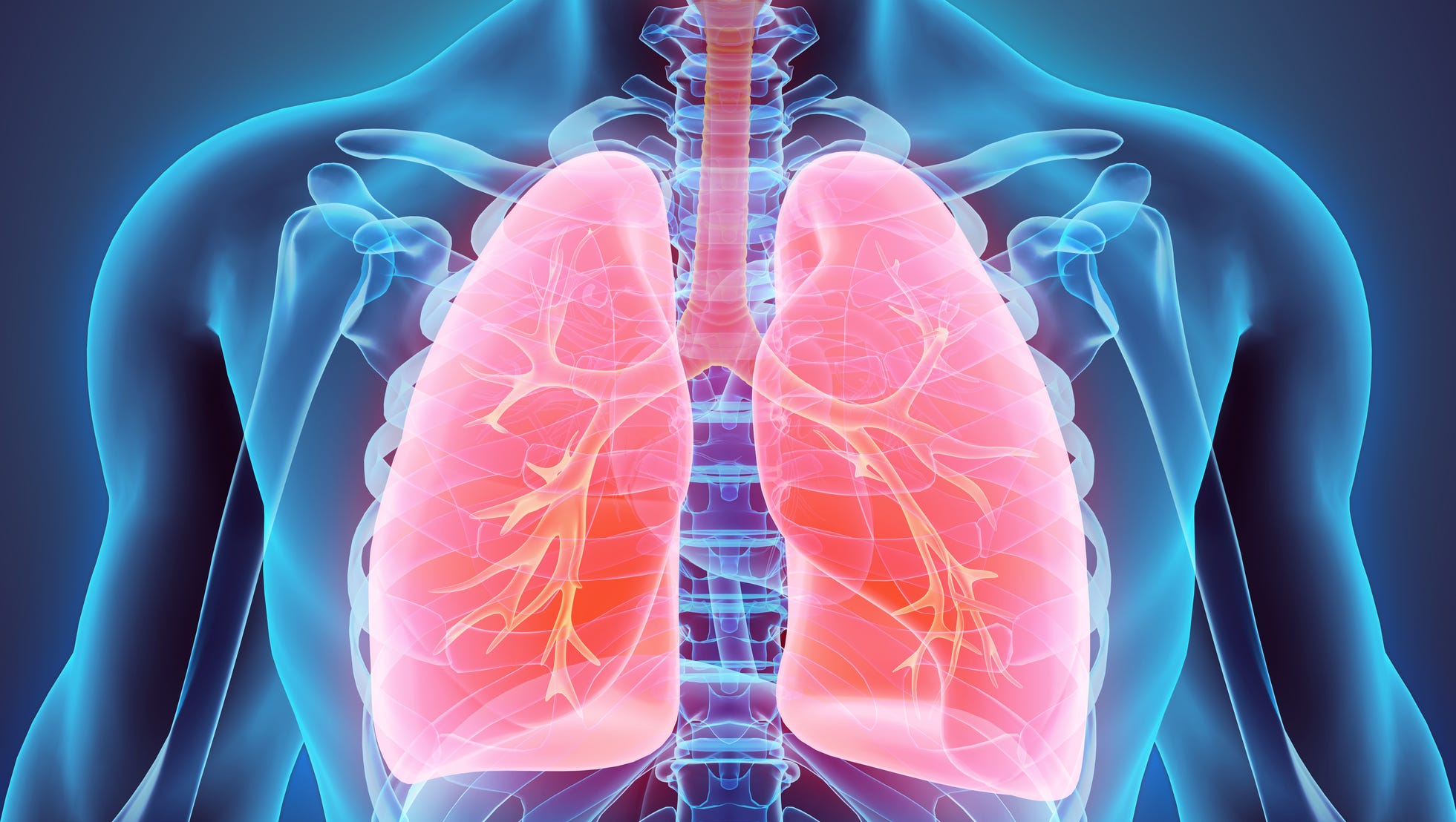 pulmonary emphysema diagnosis code