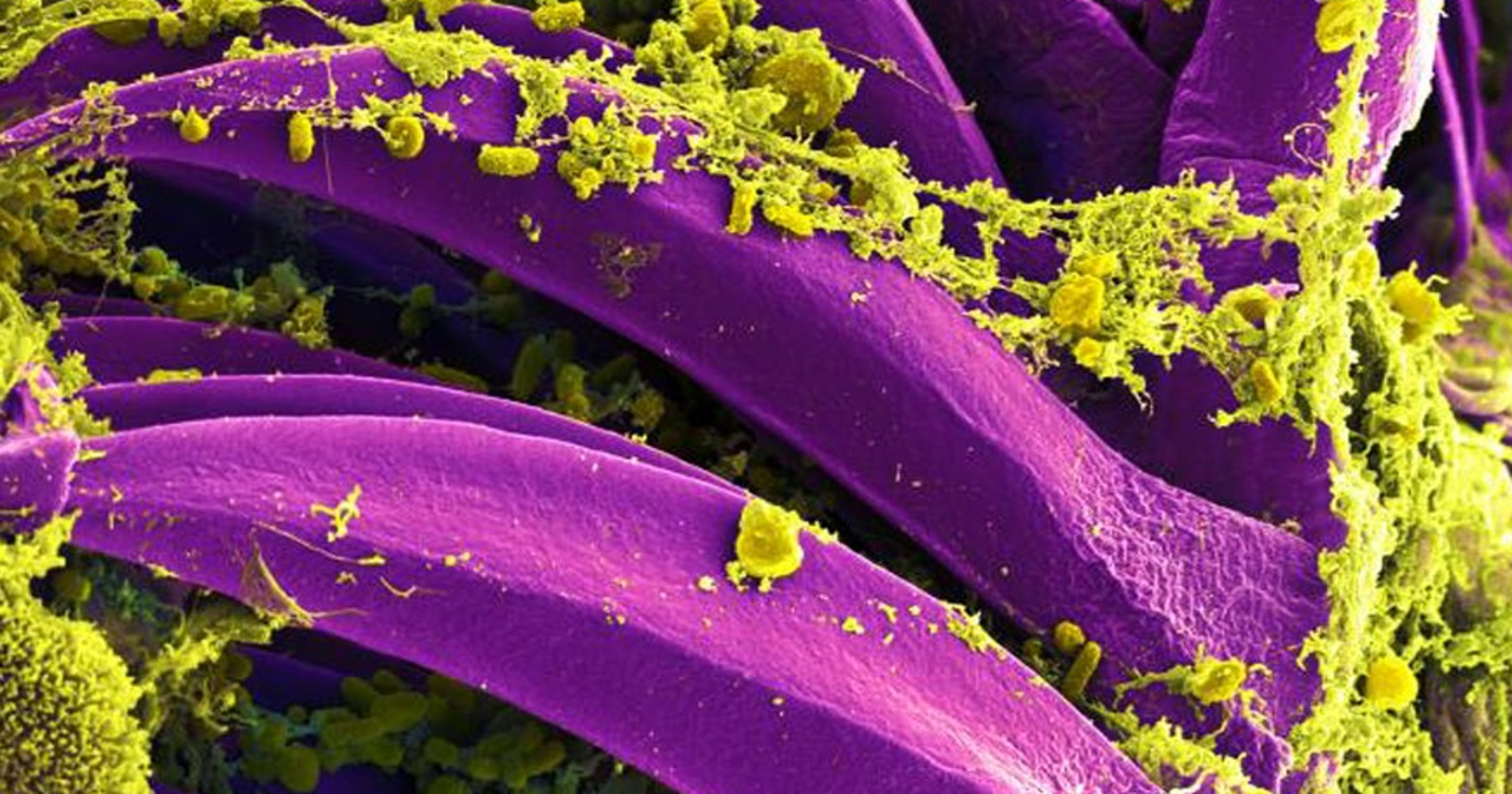 Latest military lab concerns involve plague bacteria, deadly viruses