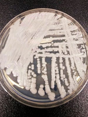 This undated photo made available by the Centers for Disease Control and Prevention shows a strain of Candida auris cultured in a petri dish at a CDC laboratory.