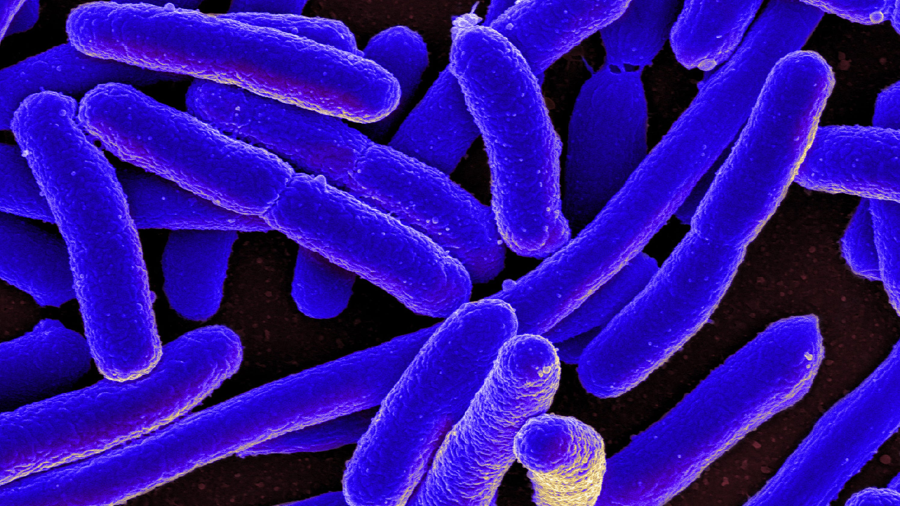 ecoli hospital outbreak Warnings about ecoli in romaine lettuce and salmonella in eggs are part of the history of 1,100 food-borne outbreaks in new york hospital outbreaks: 9 illnesses: 652 hospitalizations: 82 for further details about the potential ecoli outbreak linked to romaine lettuce. ecoli hospital outbreak Warnings about ecoli in romaine lettuce and salmonella in eggs are part of the history of 1,100 food-borne outbreaks in new york hospital outbreaks: 9 illnesses: 652 hospitalizations: 82 for further details about the potential ecoli outbreak linked to romaine lettuce.