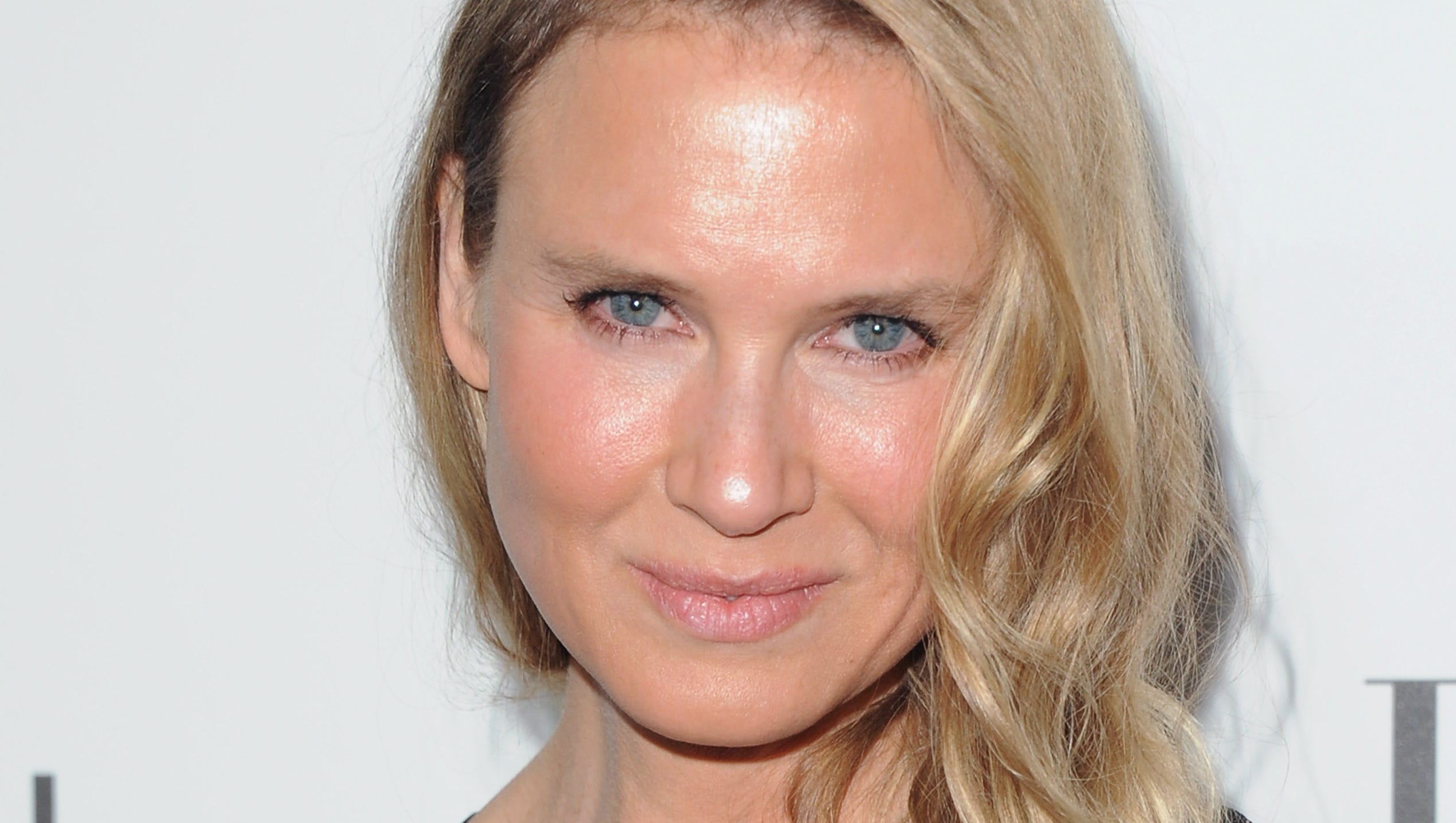 Voices Zellweger Botox And The Point Of No Return