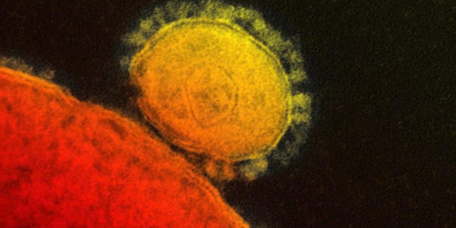 Third Coronavirus Case Confirmed In Calhoun County