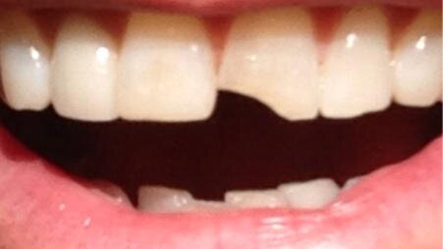 Jim Carrey posts 'Dumb and Dumber' sequel photo