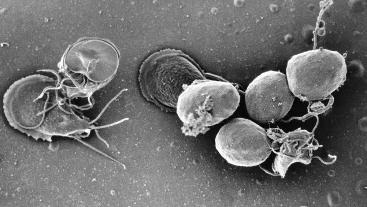 giardia la om contagios