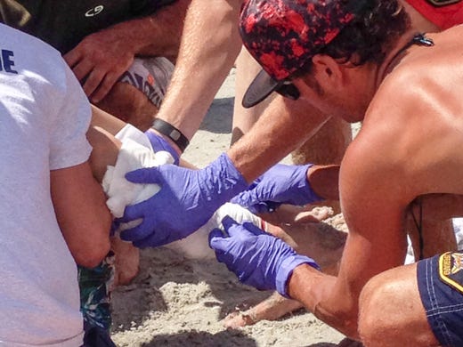 Brevard Beach Rescue with the boy bitten by the shark