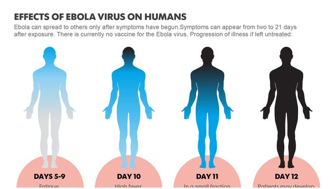 Ebola Outbreak 5 Things You Need To Know Now