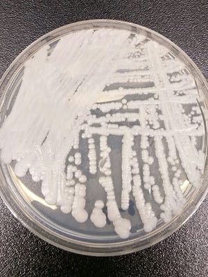 The image depicts Candida auris, a serious and sometimes fatal fungal infection that is emerging globally.