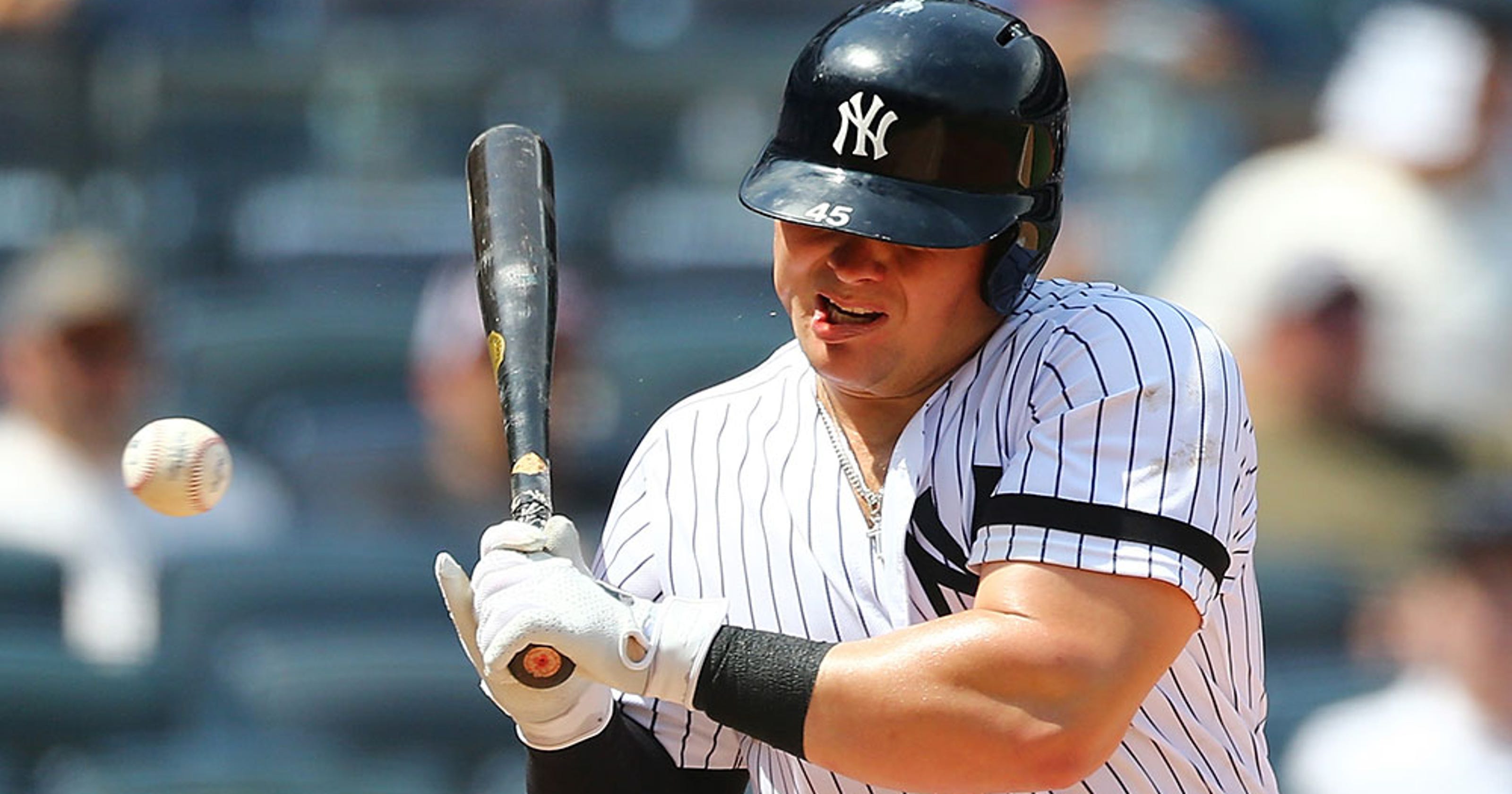 MLB Yankees' Luke Voit takes pitch to the face