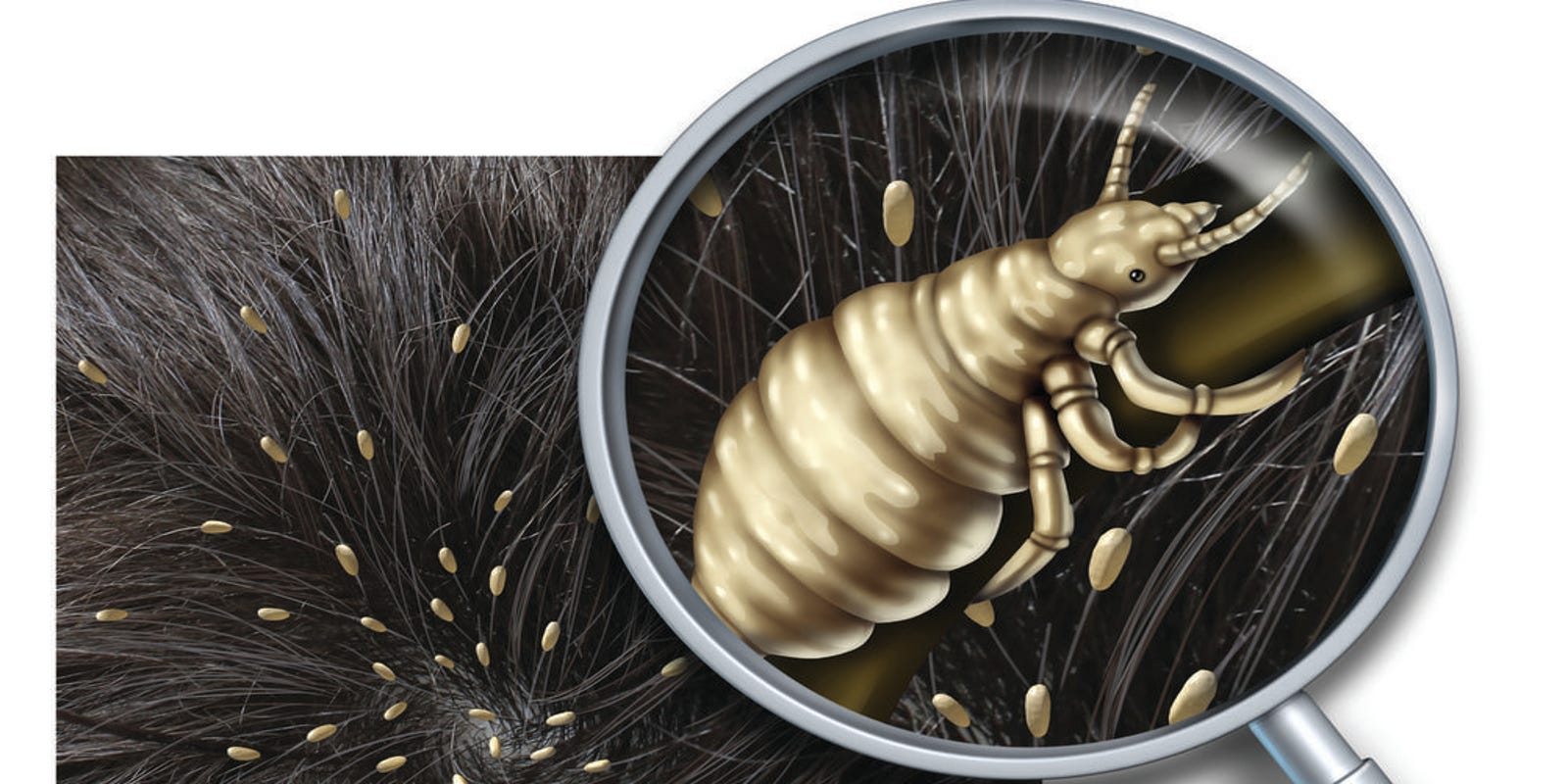 Tips To Treat Avoid Head Lice