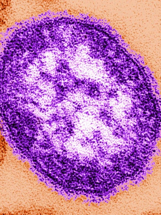 Measles Virus Warning What You Need To Know Exposure Vaccinations