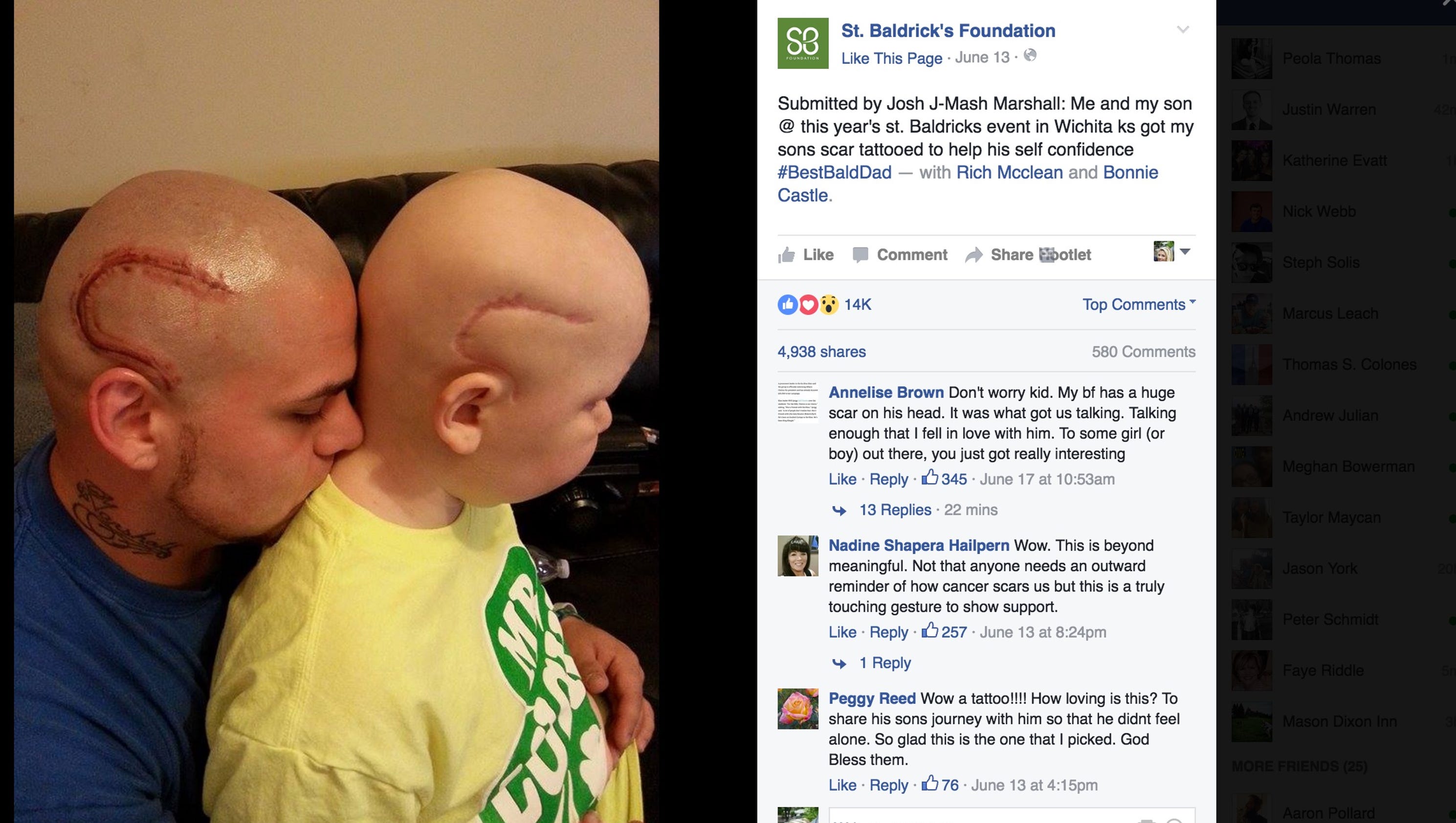 Dad gets tattoo to match his son's brain surgery scar