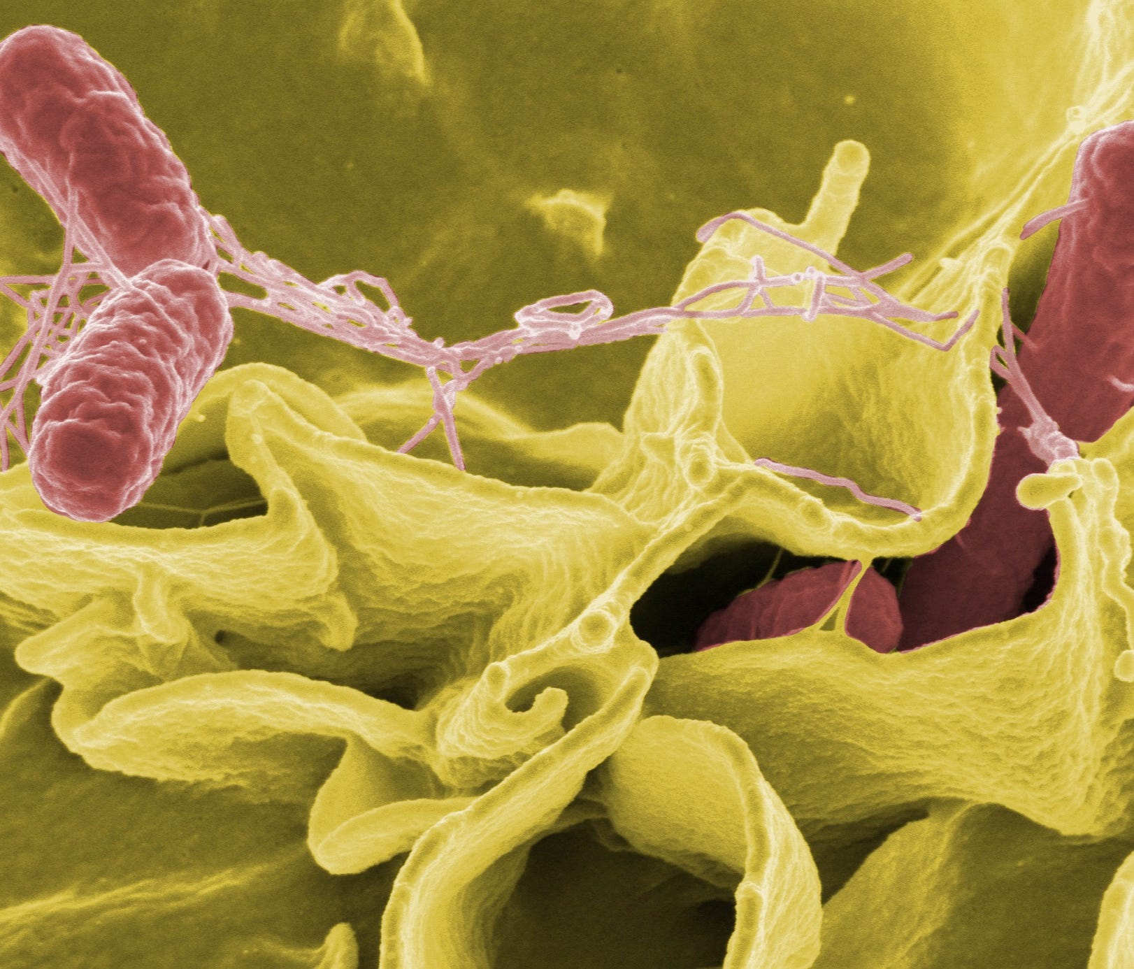 Salmonella, among other pathogens, can thrive on these common kitchen items.