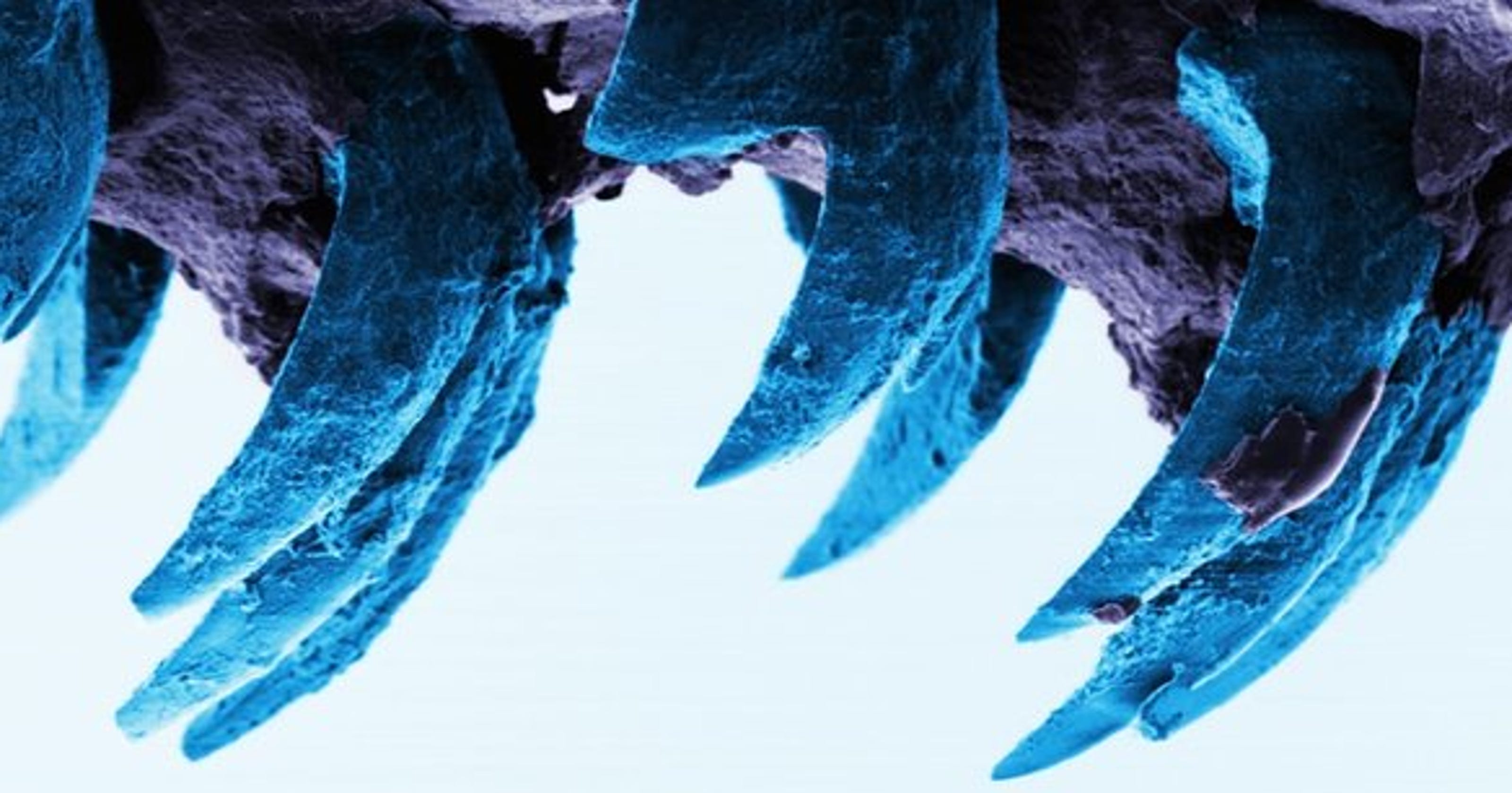 The More I Kill The Stronger I Get These tiny teeth hold the strongest material on Earth