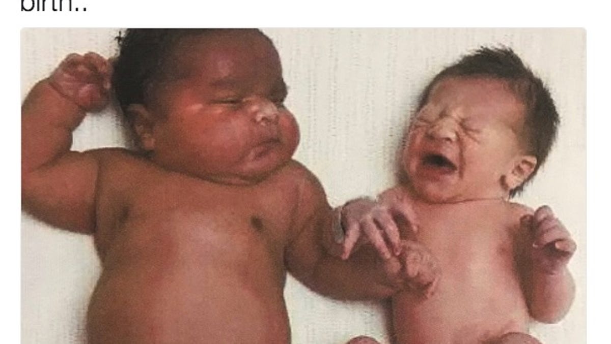 Is Having A Large Baby Safe How Do Some Babies Get So Big