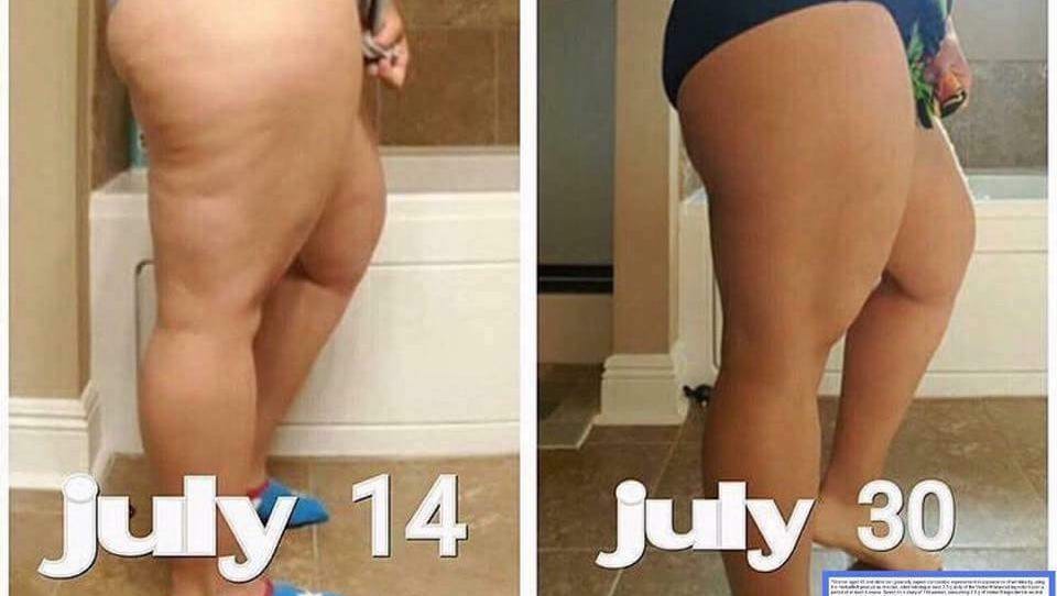 Local Collagen Supplement Users Say It Helps Reduce Wrinkles Cellulite