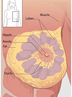The lobules are the glands that produce milk. The ducts are tubes that carry milk to the nipple. The connective tissue (which consists of fibrous and fatty tissue) surrounds and holds everything together. Most breast cancers begin in the ducts or lobules.