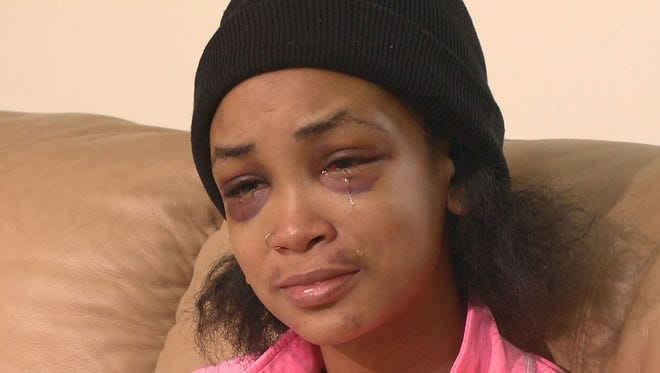 Myriah Pointer, 23, says she was brutally attacked for two hours Feb. 21, 2015, by her best friends in an Atlanta apartment after she accidentally sat on one of the women's hamburgers.