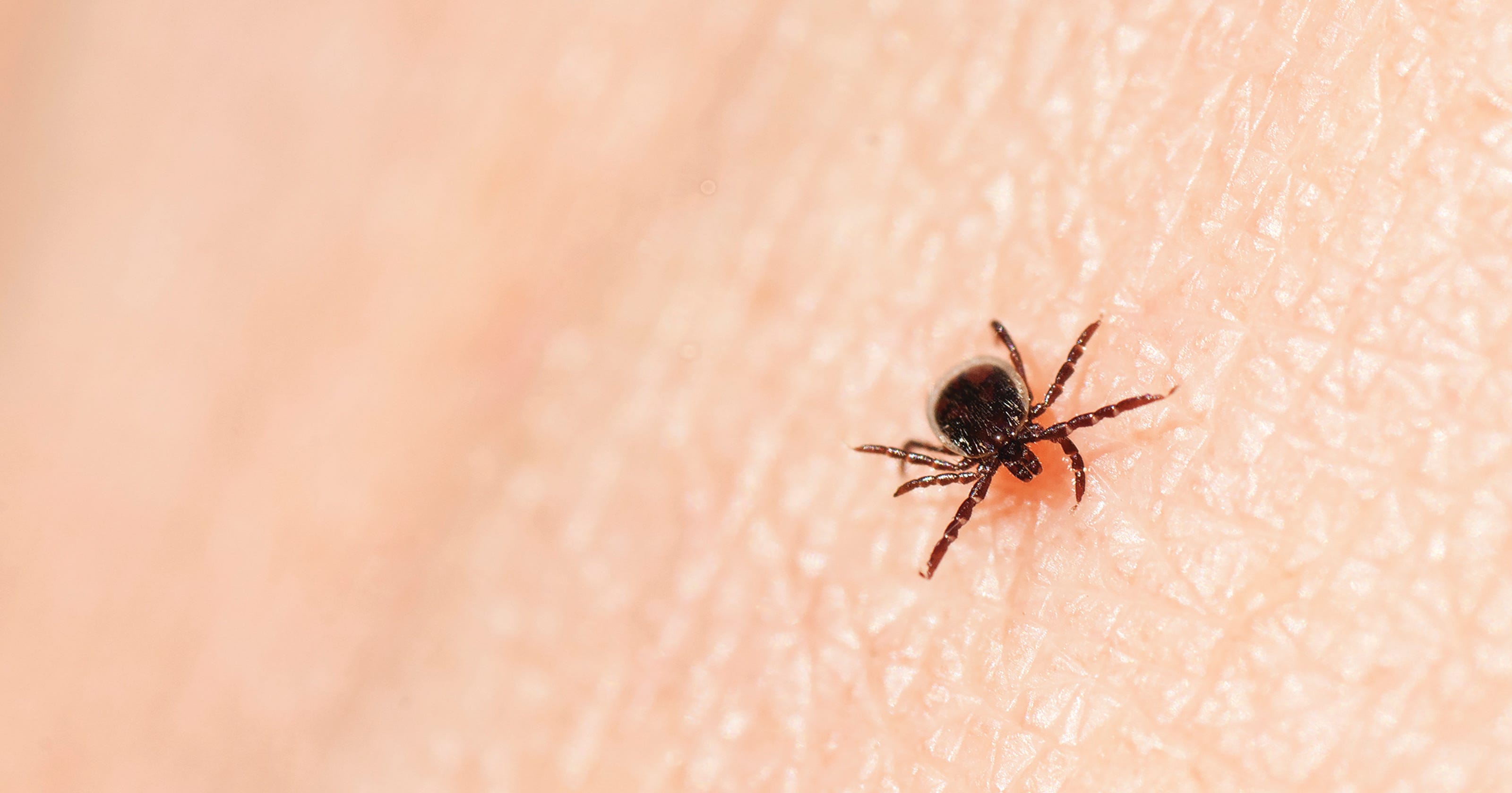 Ticks in Pa. Lyme disease symptoms, how to protect your kids, dogs