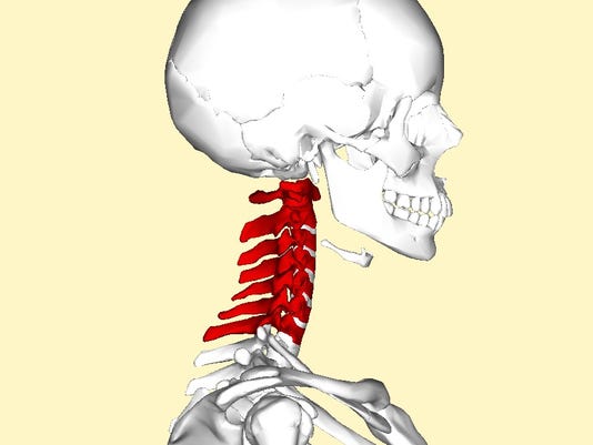 Pinched Nerve Pain Can Radiate To Other Areas