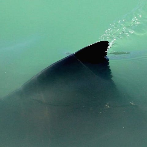 When Paige Winter, 17, was attacked by a shark,...