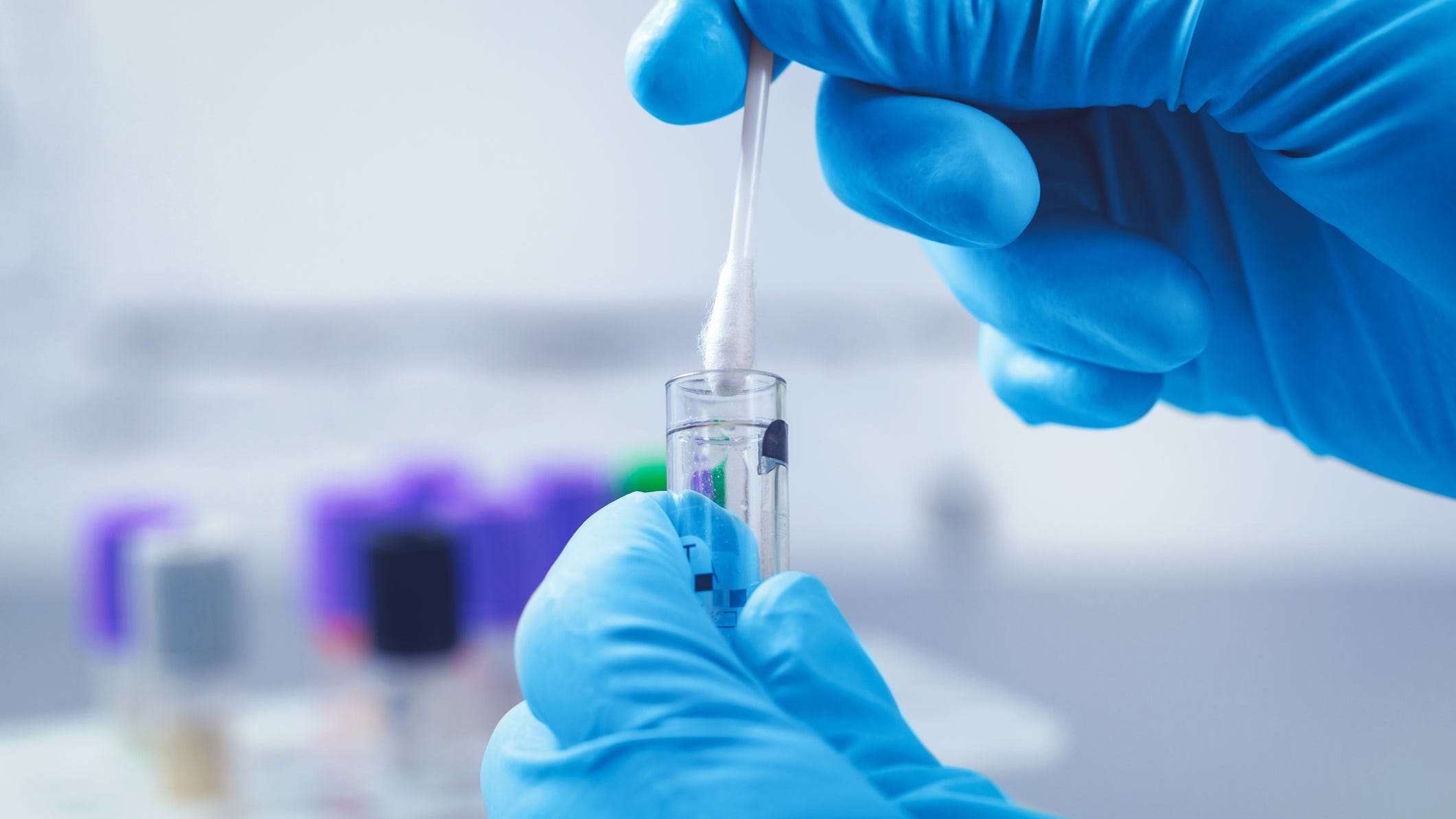 Your Coronavirus Questions Answered Symptoms Tests How To Treat