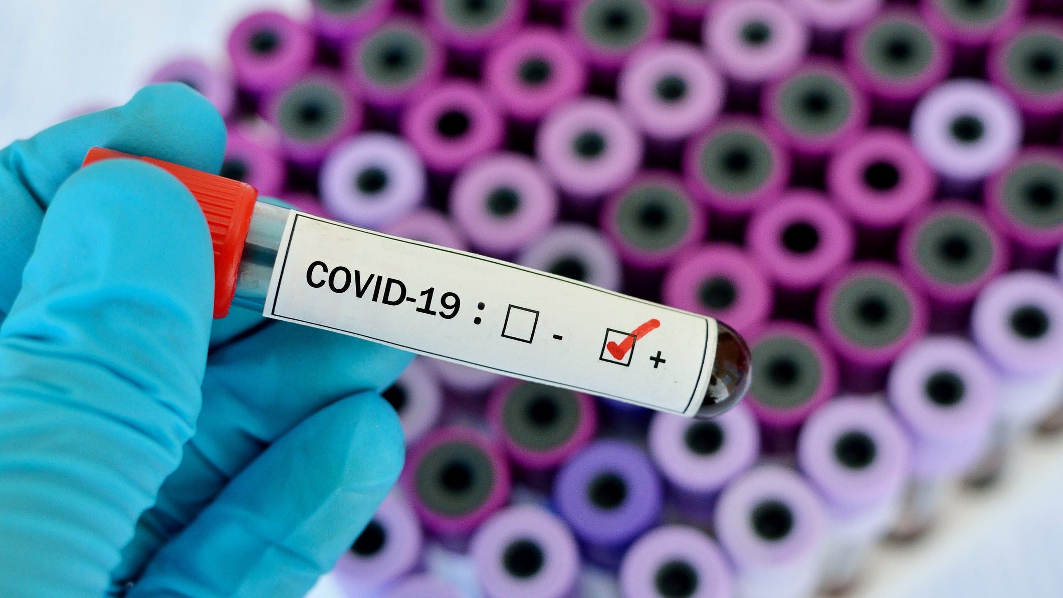 New antibody treatment offered for COVID19 patients at Cabrini