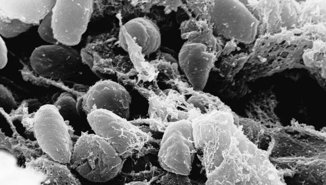 An image provided by Rocky Mountain Laboratories showing an electron micrograph depicting a mass of Yersinia pestis bacteria (the cause of bubonic plague).