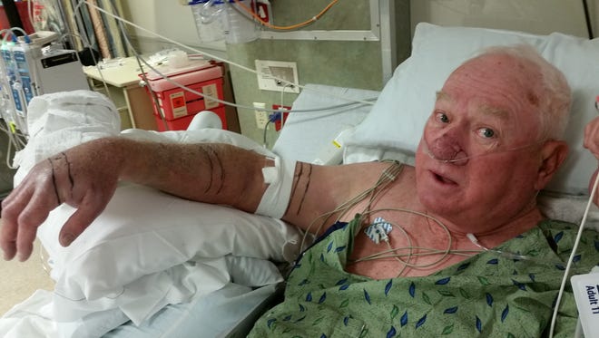 Ralph Shelton was bitten by a rattlesnake and doctors tell him he is lucky to be alive.