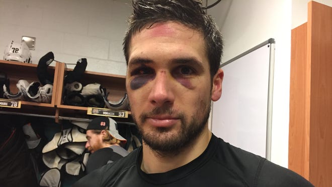 Chris VandeVelde had some battle scars after being hit into the boards last Saturday.