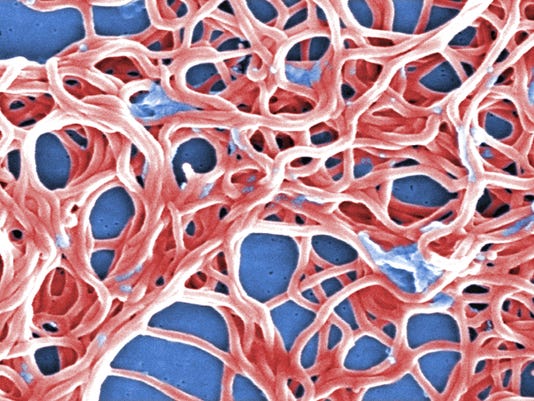 Lyme: Are bacteria (or research) being starved to death?