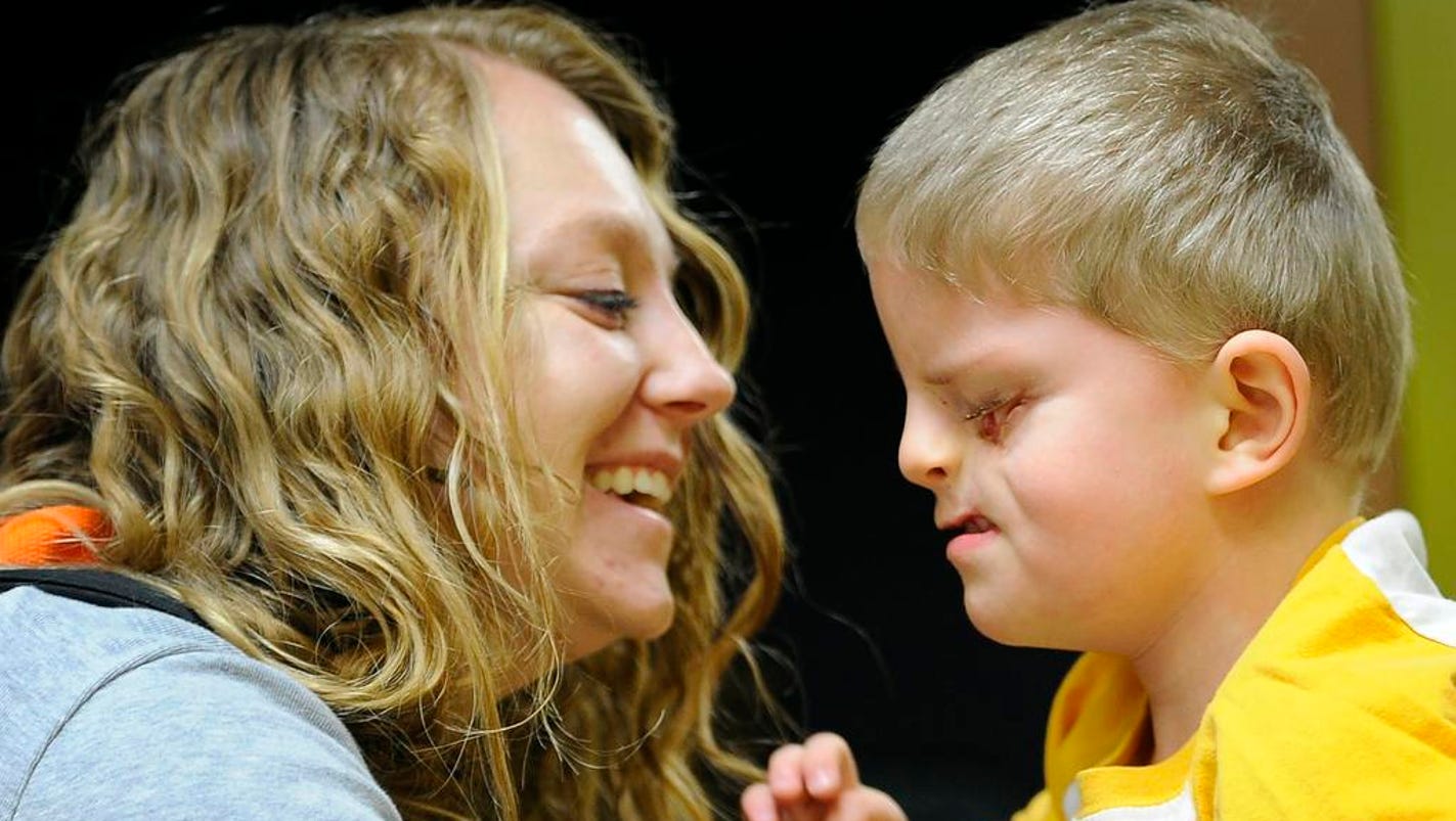 4yearold's rare birth defect inspires blinding love