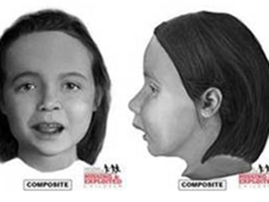 Facial reconstruction of girl