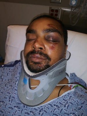 Christopher Divens in the hospital after he was hit by a police cruiser