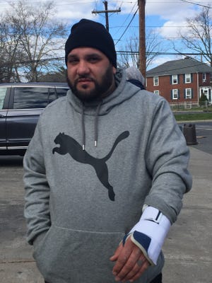 Edward Minguela of Camden shows a splint on a wrist he says was broken during an assault by a police officer.