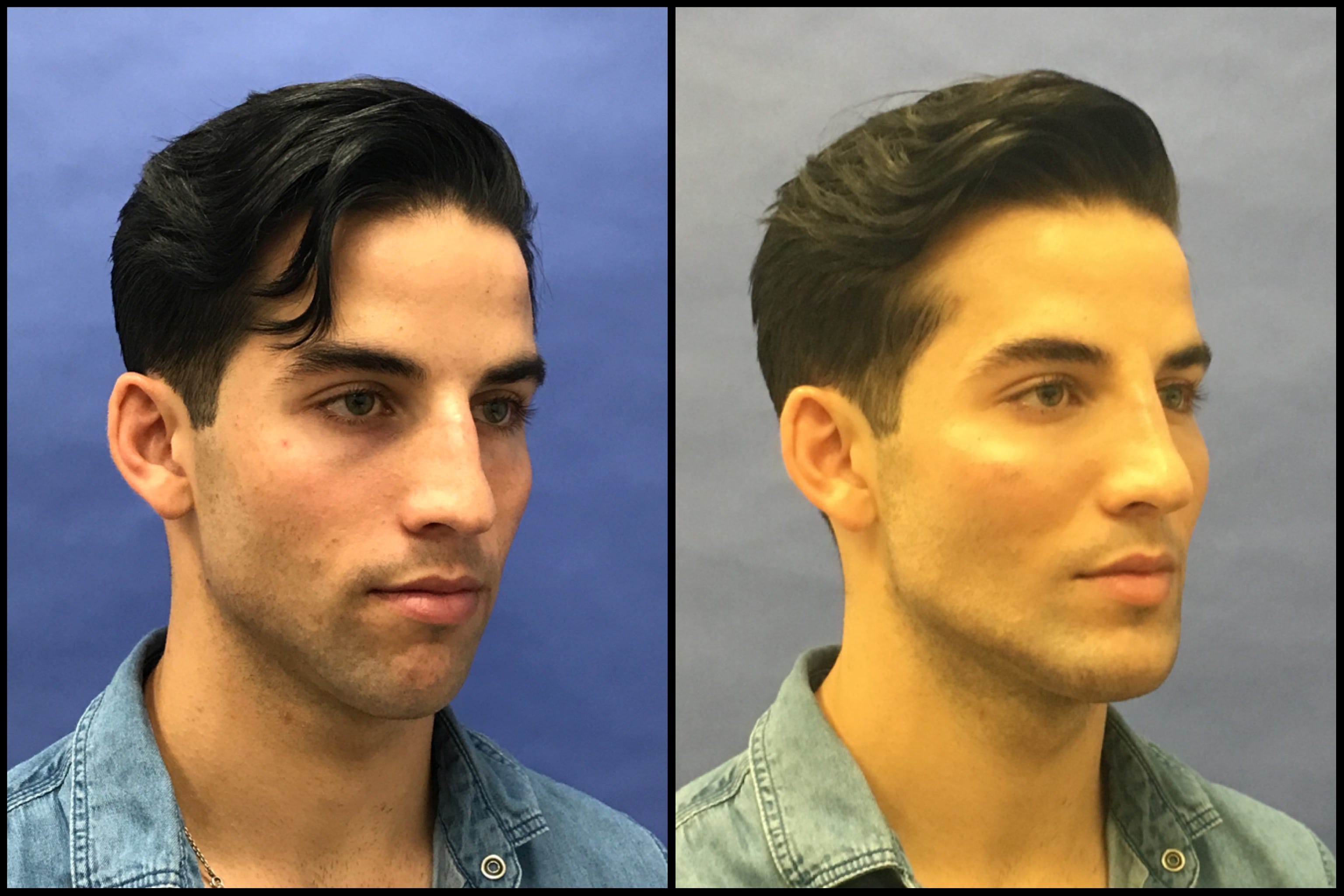 free male plastic surgery
