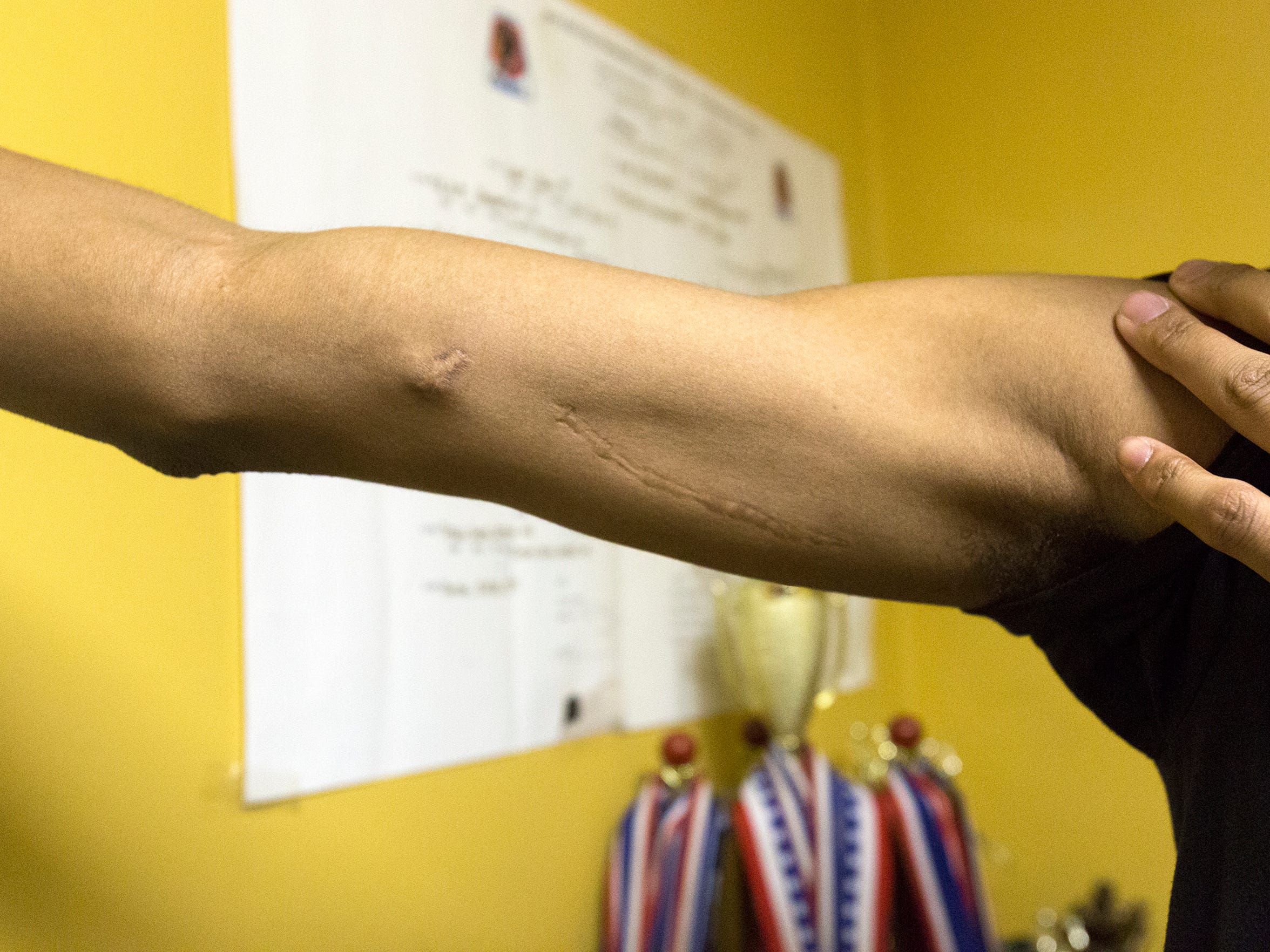 Meet the youngest survivors of Detroit's shootings and violence