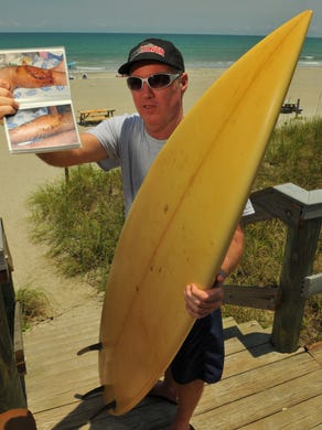 Ralph Sammis of Melbourne Beach talks about getting bitten by a Black-tip shark while surfing in South Melbourne Beach on April 21st 2003, the injury required nearly 100 stitches and three months in rehab .