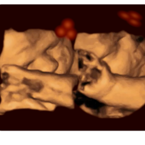 A 4-D ultrasound of a fetus tracking the stimulus 