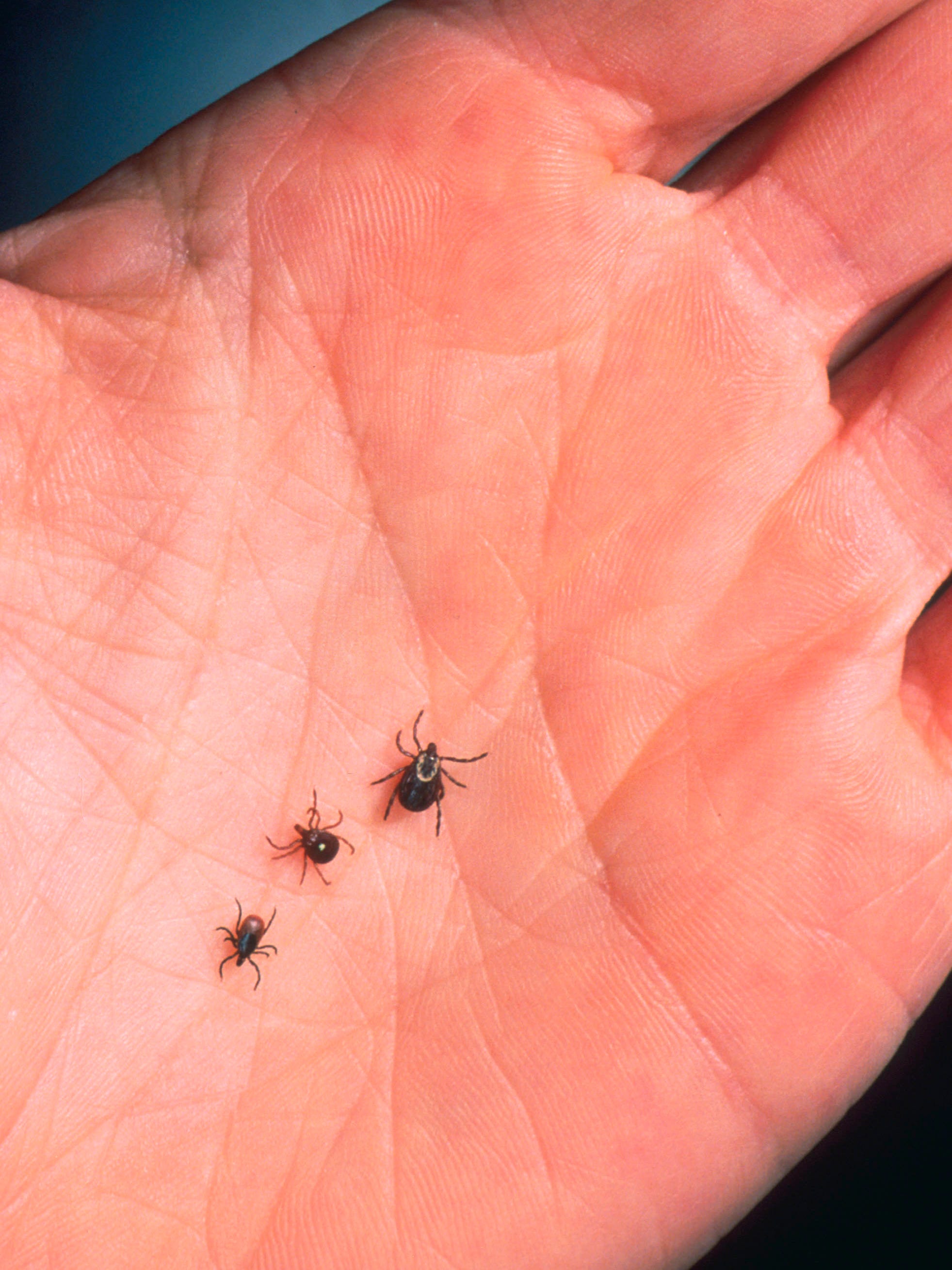 Tick Caused Lyme Disease Up In Oregon But Tiny Compared To East Midwest