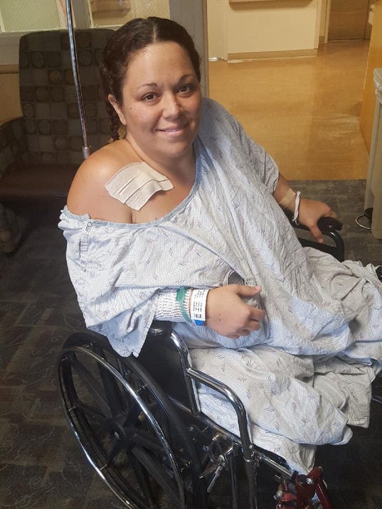 Cape Coral company offers prosthetic legs to double amputee