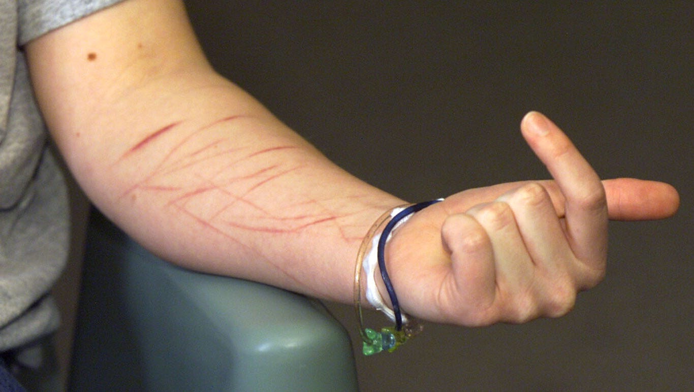 Army Now Accepting Recruits With History Of Serious Mental Illnesses