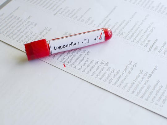 Legionnaires Confirmed In 7 Patients Treated At Mclaren