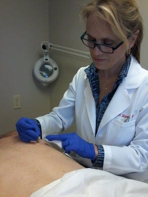Dr. Shari Skinner of Associates in Dermatology is doing a biopsy for a suspicious lesion. May is Melanoma month and people are encouraged to get screened.