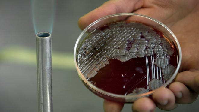 Chemistry student Jorge Rodriguez Martinez holds a sample of billions of anthrax bacteria at the National School of Biological Sciences in Mexico City.