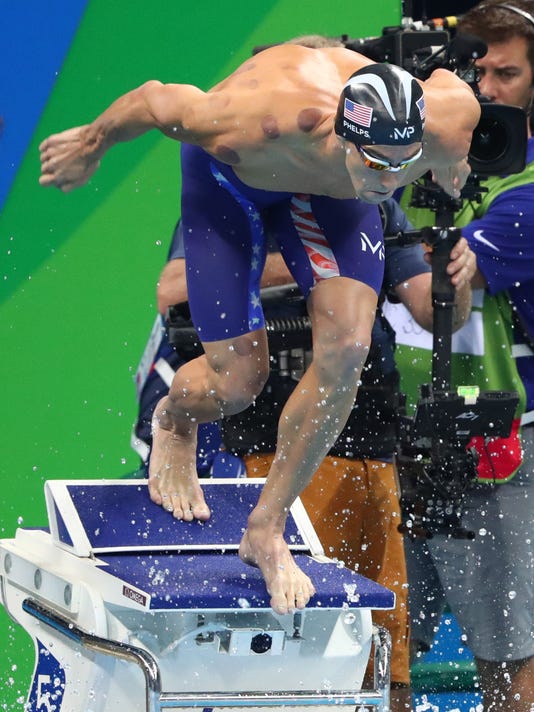 How cupping works and why Olympic athletes use it