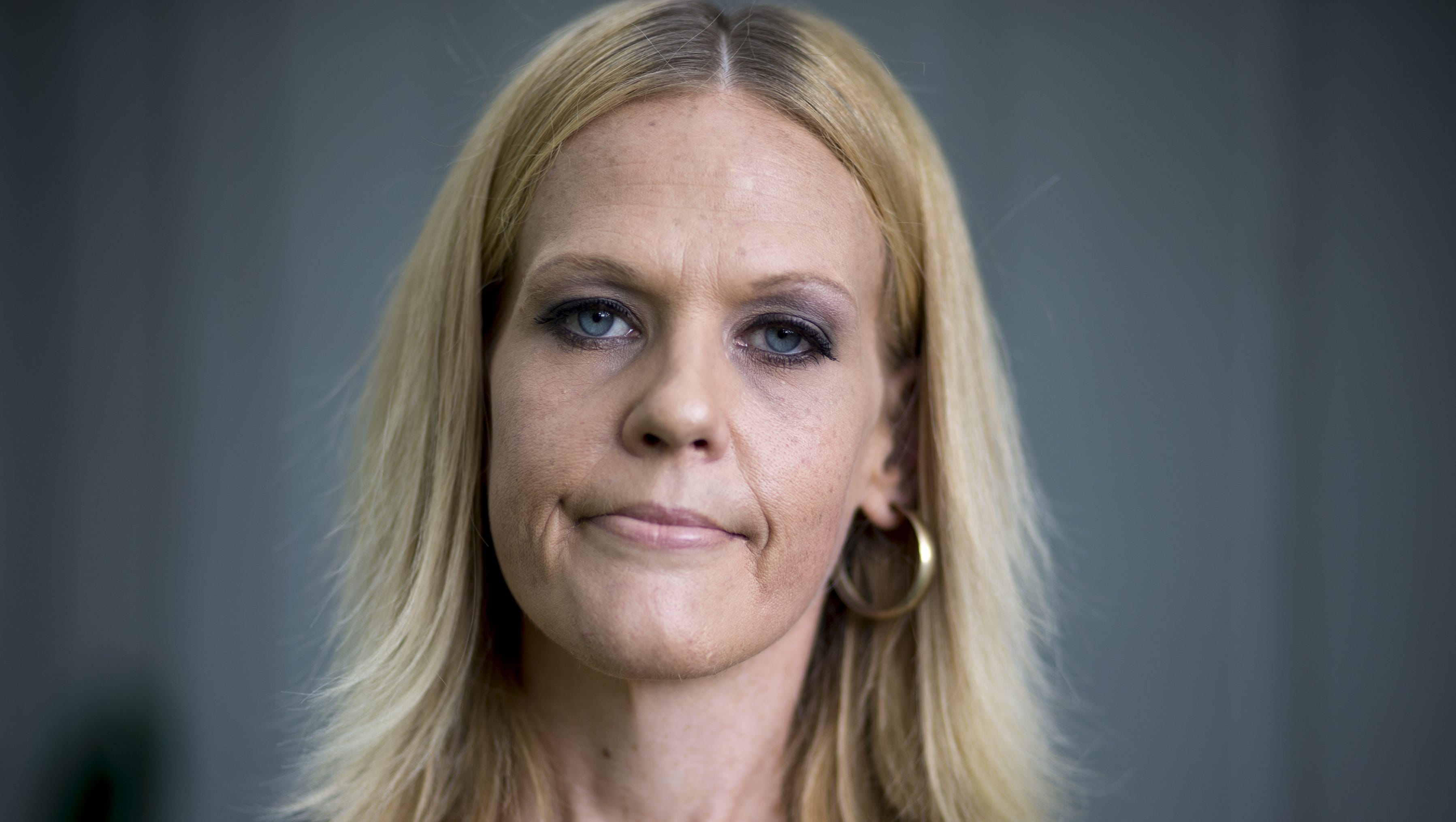 Weight Loss Surgery Is Lucrative For U S Middlemen Claim Says