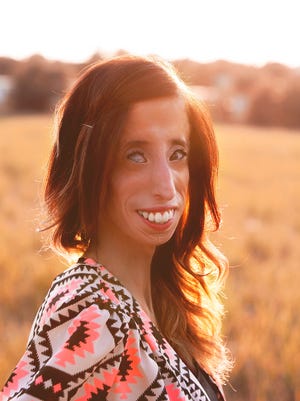 Lizzie Velasquez will screen her anti-bullying film at the Robinson Film Center.