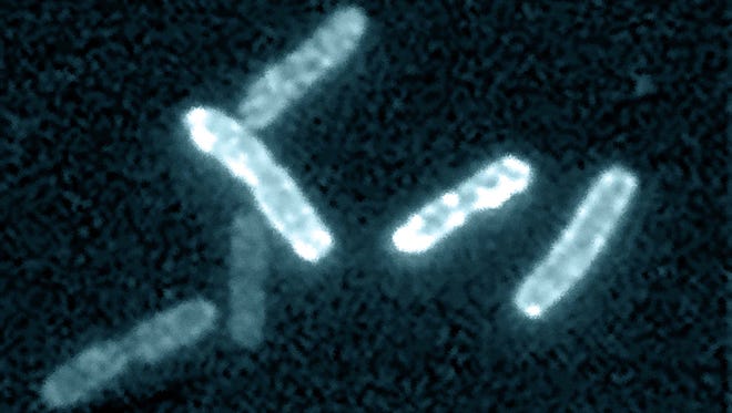 Microscopy image of E. coli bacteria.